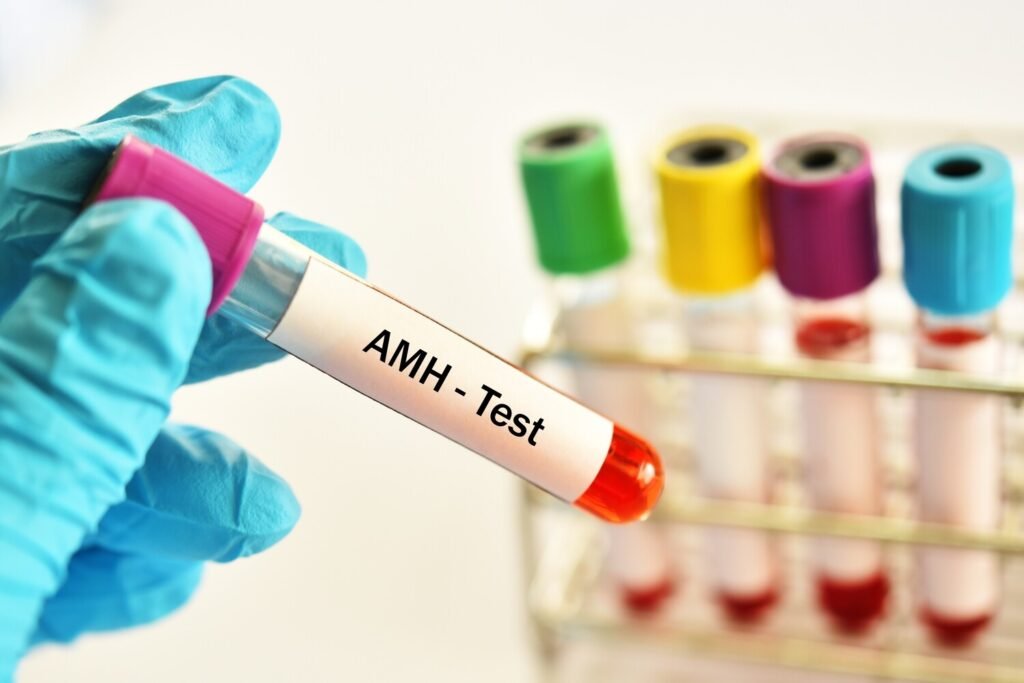 anti Mullerian Hormone