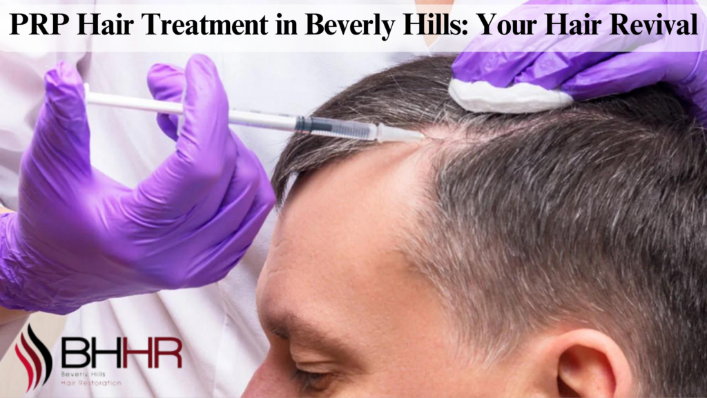 prp hair treatment beverly hills