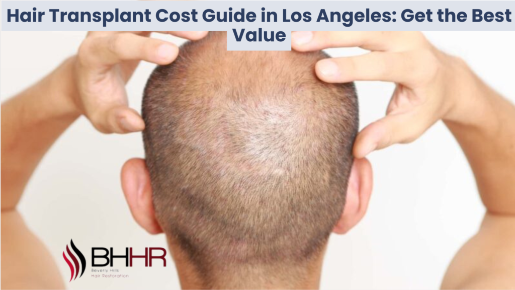 hair transplant los angeles cost