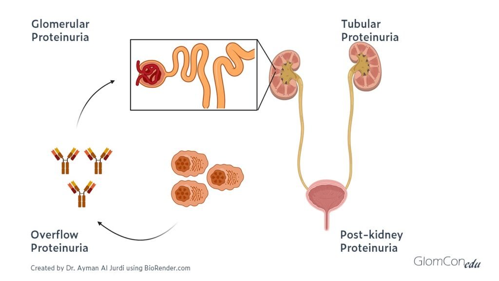 Proteinuria